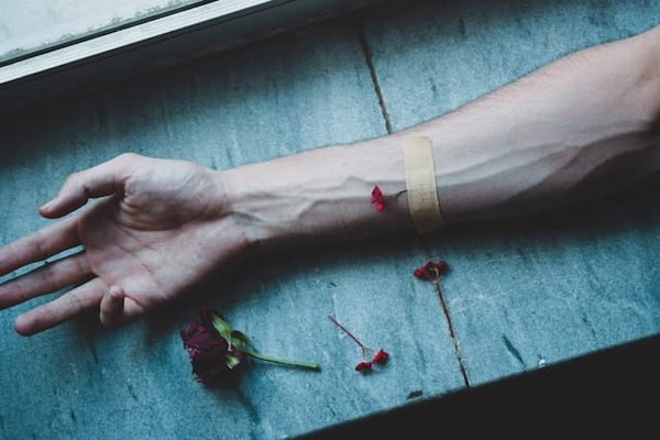 Quels exercices spécifiques de rééducation pour le poignet après une fracture de scaphoïde ?